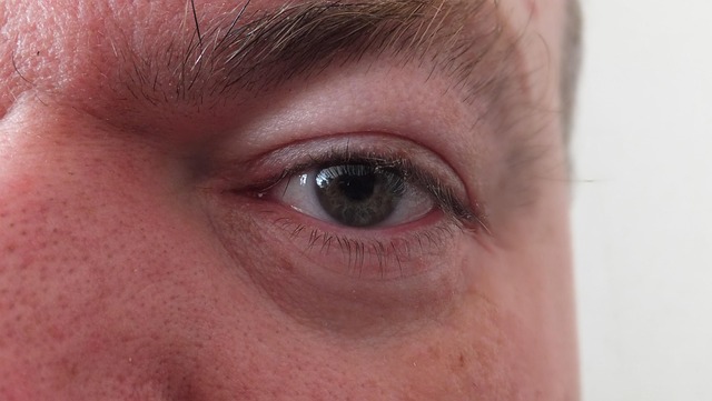 Blepharoplasty Recovery Kits: Pairing Medical Care with Digital Essentials Blepharoplasty Recovery Kits: Pairing Medical Care with Digital Essentials